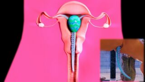 Birth of a tentacle – Lara pregnant - ﻿3D animation on Crohasit