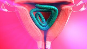 Tifa’s tentacle hyperinflation (X-ray version) - ﻿3D animation on Crohasit