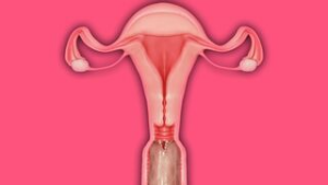 X-Ray tentacle penetration [Palefire34] - ﻿3D animation on Crohasit