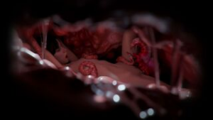 Garden Meat - ﻿3D animation on Crohasit